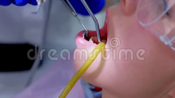牙科医生在治疗期间用唾液喷射器向女性牙齿泼水特写镜头视频的预览图