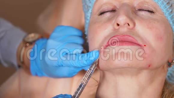 整形外科医生用肉毒毒素去除女人脸上的皱纹视频的预览图