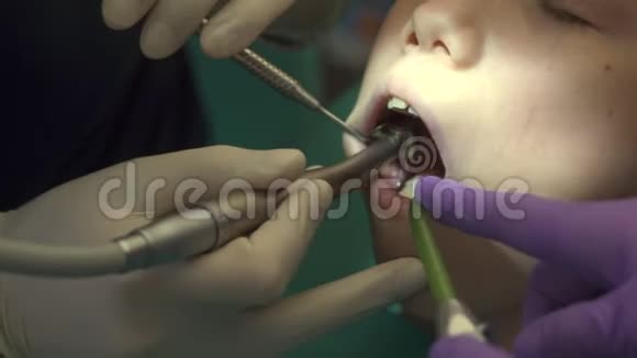 儿童牙医检查儿童视频的预览图