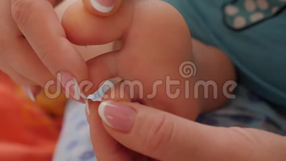 一个小男孩的特写他的脚皮肤和手指上有水痘的皮疹视频的预览图