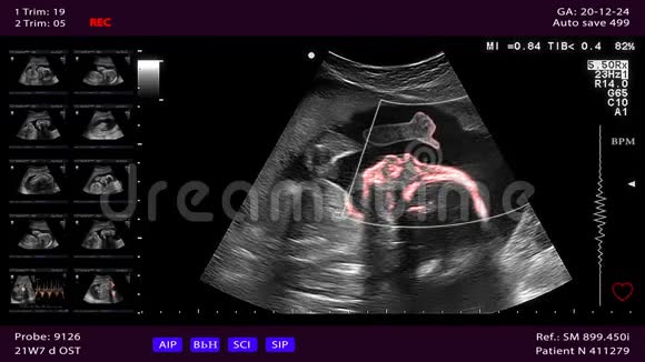 未出生的婴儿把拇指从子宫里伸出来视频的预览图