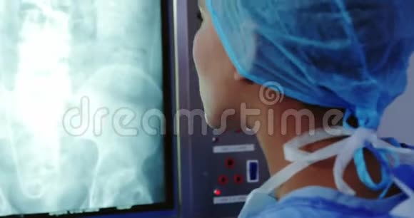 美籍非裔女医生在医院检查灯箱X光报告的特写视频的预览图