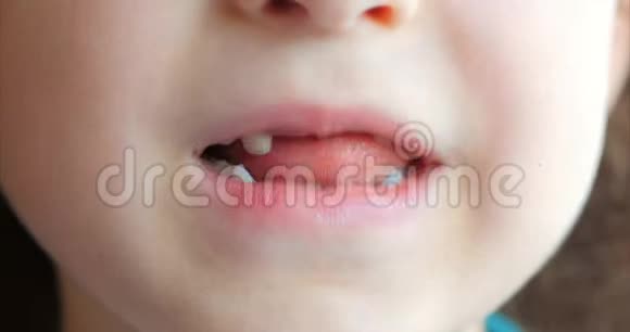 小女孩微笑宝贝牙齿孩子咬他的舌奶牙视频的预览图