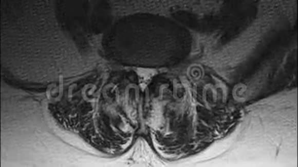 女性盆腔腹腔胃肠道和膀胱的MRI净化视频的预览图
