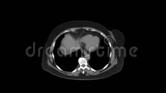 净化腹部胃肠道膀胱的MRI视频的预览图