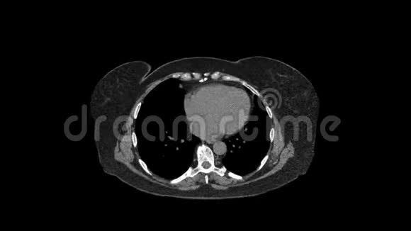 净化腹部胃肠道膀胱的MRI视频的预览图