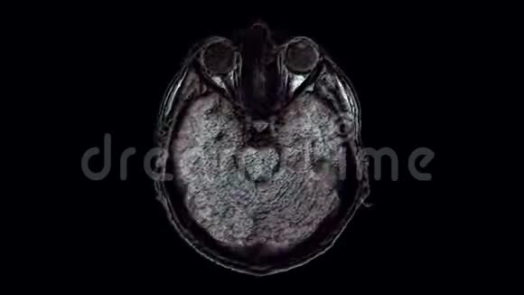 对大脑和头部进行大量的彩色MRI扫描以发现肿瘤诊断医疗工具视频的预览图