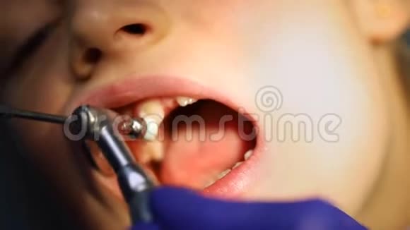 牙科医生为口腔科的儿童做专业的牙菌斑清洁和牙齿抛光视频的预览图