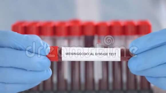 戴防护手套的实验室助理持有脑膜炎球菌测试的实验室管视频的预览图