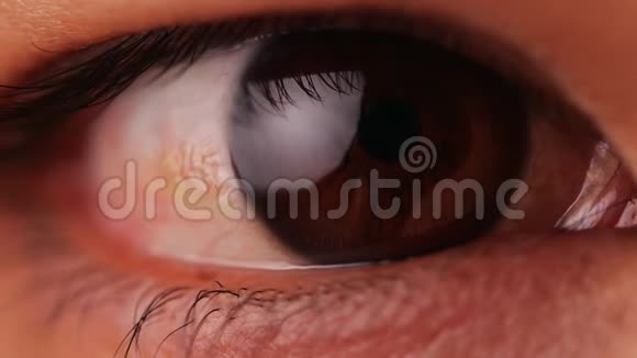 棕色眼睛在慢动作中闪烁女人正在用翼状胬肉睁开和闭上眼睛视频的预览图