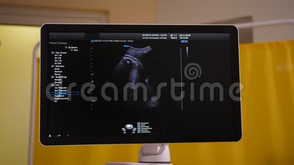 超声机屏幕上胎儿图像视频的预览图