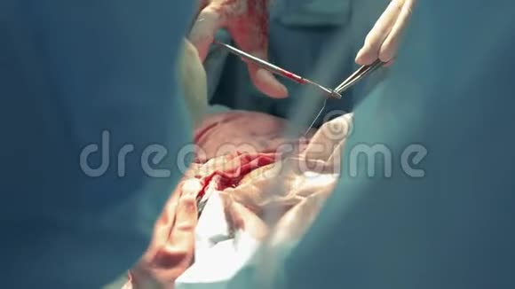 医生在医院工作做手术视频的预览图