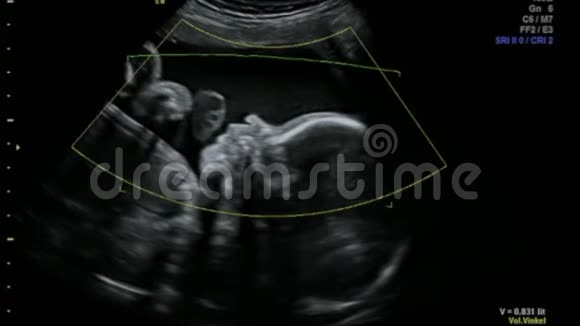 婴儿揉搓鼻子和玩母亲脐带视频的预览图