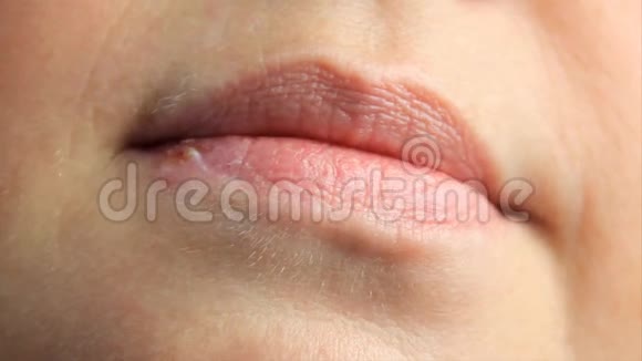 嘴唇上有疱疹疮的女人疱疹唇部护理4k慢镜头复制空间视频的预览图