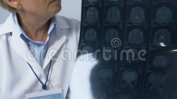 女医生显示脑部X光和摇头病人POV晚期疾病视频的预览图