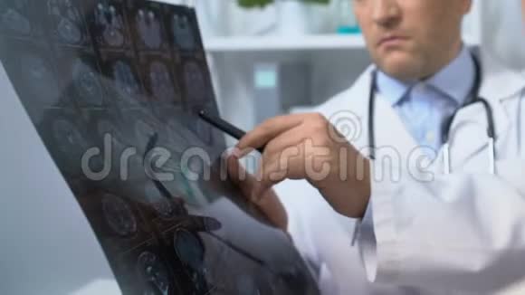严重的男性医生显示病人的脑部x光结果肿瘤癌症的风险视频的预览图