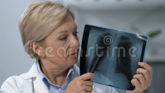 女性肿瘤学家显示肺部X光和摇头晚期癌症视频的预览图