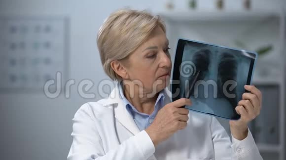 老年女医师检查肺部x光及摇头扫描结果不良视频的预览图