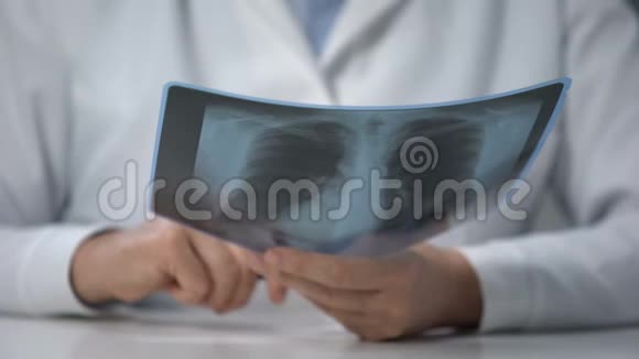 戴眼镜的老女医生看肺x光和摇头坏消息视频的预览图