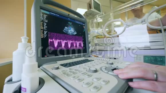 婴儿手术过程中的超声机制视频的预览图