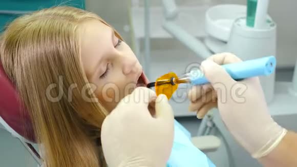 牙科诊所的小可爱女孩得到了治疗来填补牙齿的空洞牙科修复和材料视频的预览图