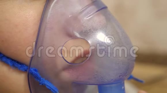 咳嗽治疗特写镜头一名戴口罩的患病妇女被吸入戴着蓝色医院面具的女孩吸入蒸气处理视频的预览图