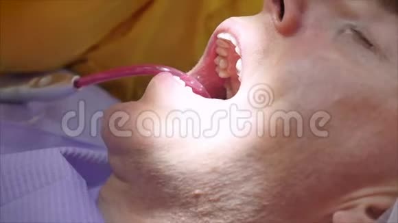 人在牙医那里接受口腔检查和治疗女牙医治疗牙齿视频的预览图