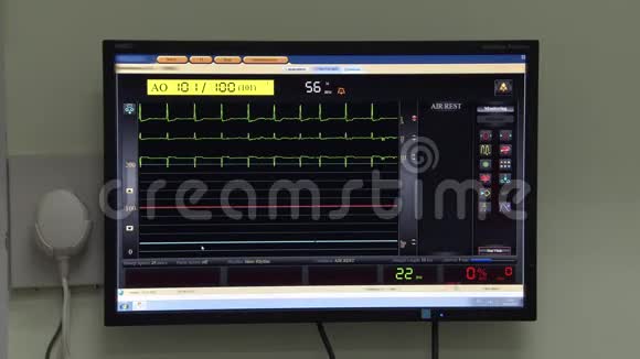 医院心率监测仪附图视频的预览图