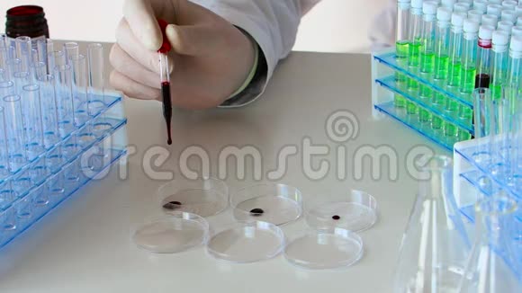 研究员把血样滴在培养皿里视频的预览图