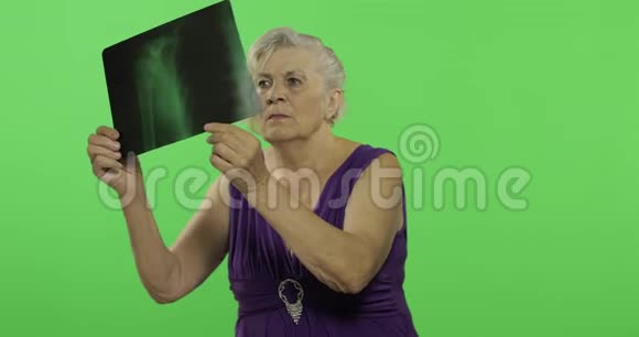 一位老年妇女正在检查她的x光图像老奶奶铬键视频的预览图