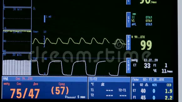 显示病人生命体征的心脏和病人监视器医学就是保健现代运作现代视频的预览图