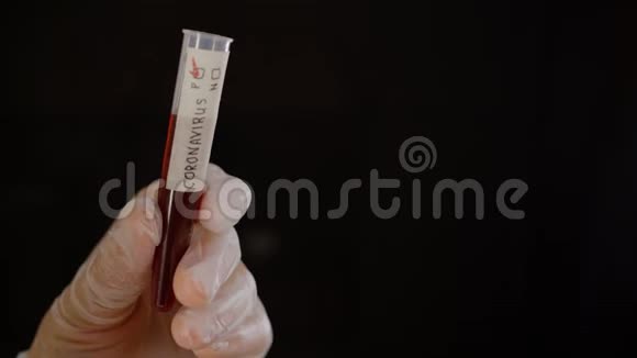 手拿血液样本与冠状病毒感染视频的预览图