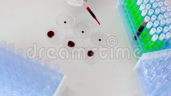 研究员双手在培养皿中滴着血样关闭录像视频的预览图