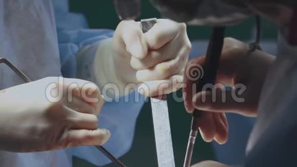 外科手术术中关闭手术手拿医疗钳外科手和医疗工具视频的预览图