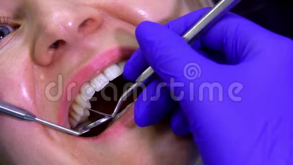 关闭牙医检查病人牙齿视频的预览图
