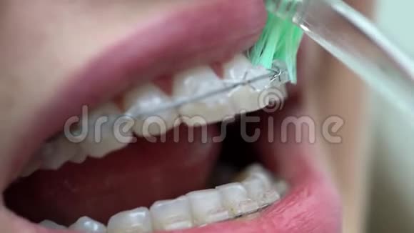 牙科诊所清洗病人牙托视频的预览图