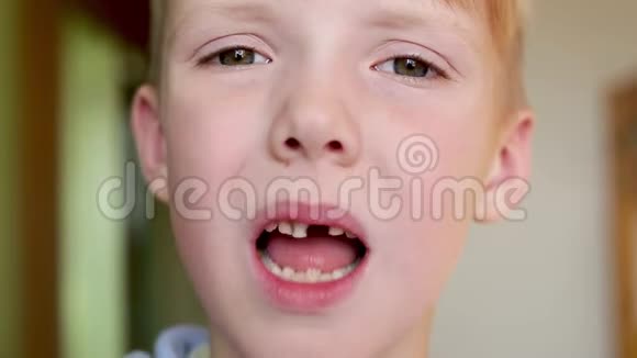 严肃的男孩露出了他松动的牙齿视频的预览图