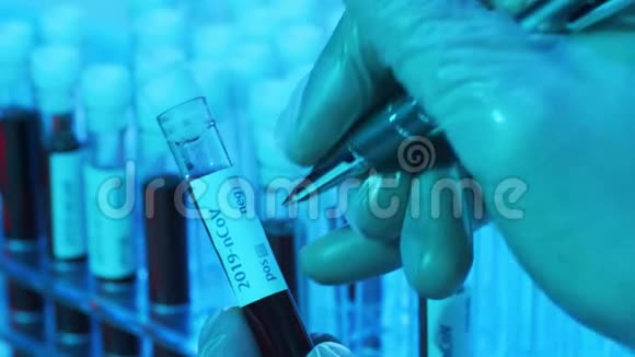 带有血液和病毒的实验室管医院科学实验室的特写流行病保健疫苗视频的预览图