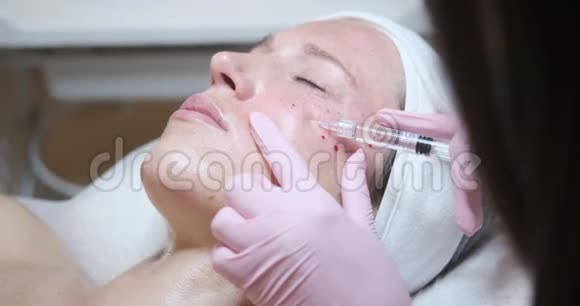 女人在脸颊上注射肉毒杆菌视频的预览图