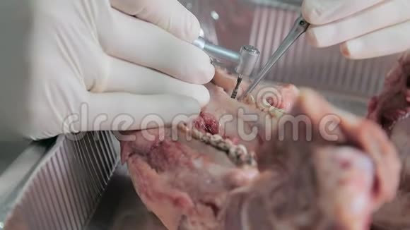 受训的牙医在一个猪的下巴模型上进行牙科治疗特写特写镜头使切口围绕视频的预览图