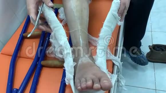 一个年轻人在医院用剪刀把腿上的石膏去掉拐杖就在附近视频的预览图