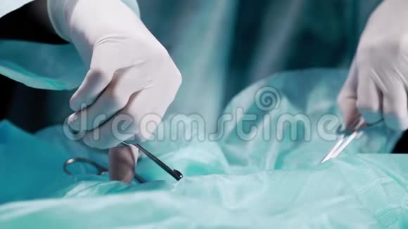 医生的手紧紧地抓住一滴血用夹子把它拉出来医生做一个特写手术视频的预览图