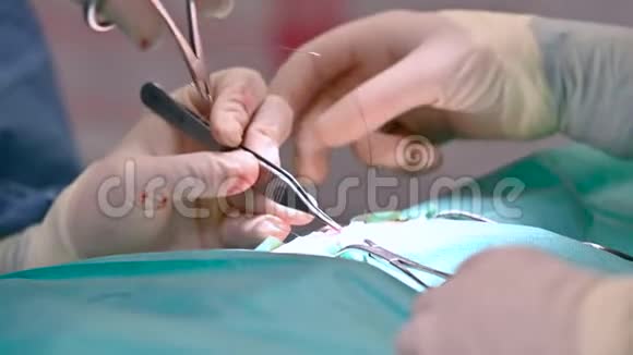 兽医小组操作一只猫外科医生缝制纸巾猫特写的灭菌腹部手术医疗视频的预览图