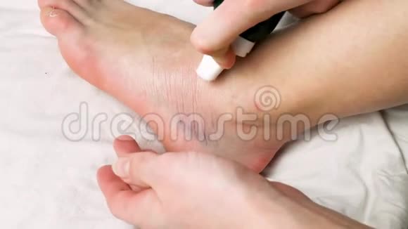 女人正在用弹性绷带在扭伤的脚踝上涂上凝胶扭伤的脚踝有白色背景的瘀伤视频的预览图