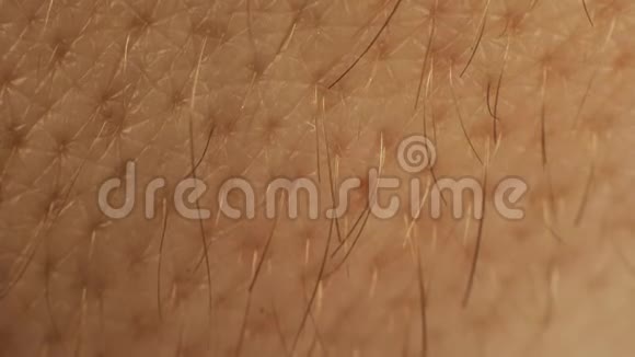 从手或手臂上的皮肤长出的毛发的宏观照片白人男性白种人的身体部位皮肤科和视频的预览图
