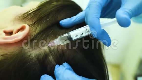 整容手术是通过中间疗法将病人的血浆注入的方法进行头发再生视频的预览图