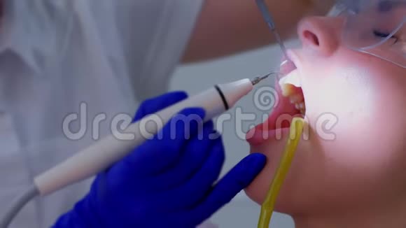 牙科保健员牙科医生给女性做超声波洁牙特写视频的预览图