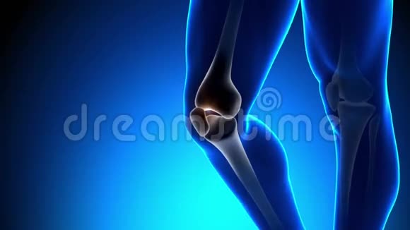 膝关节疼痛X光概念视频的预览图