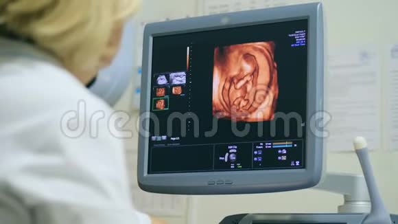 医生用超声波检查子宫里的婴儿视频的预览图