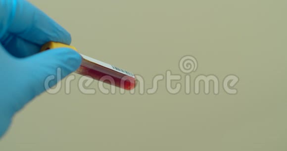 医生显示管冠状病毒血检结果阳性covid2视频的预览图